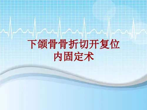 手术讲解模板：下颌骨骨折切开复位内固定术
