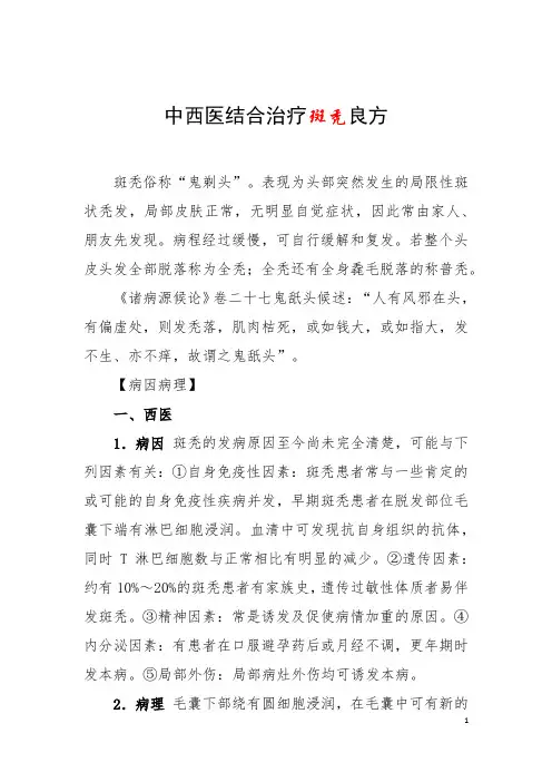 中西医结合治疗斑秃良方
