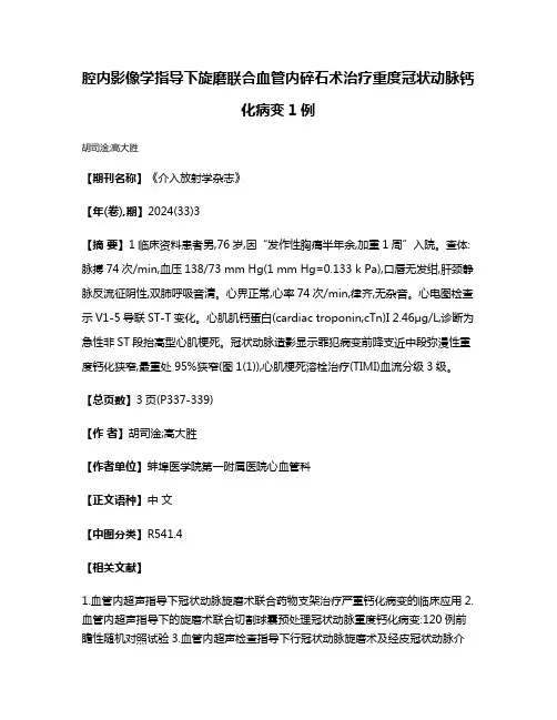 腔内影像学指导下旋磨联合血管内碎石术治疗重度冠状动脉钙化病变1例
