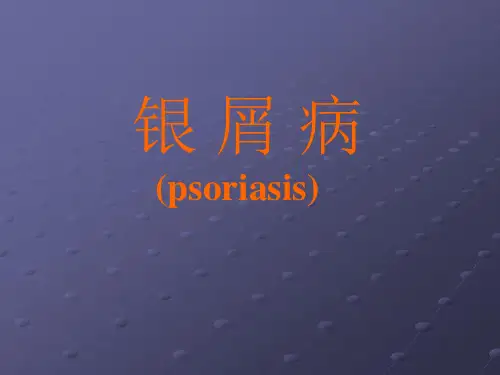 皮肤病：银屑病(psoriasis)