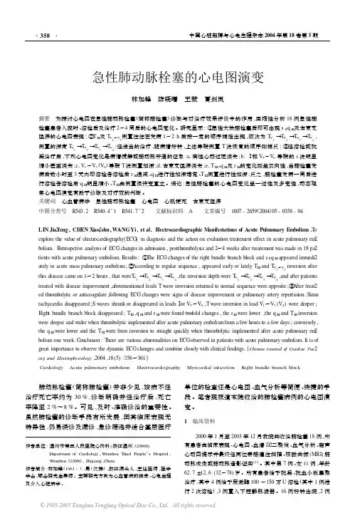 急性肺栓塞心电图演变