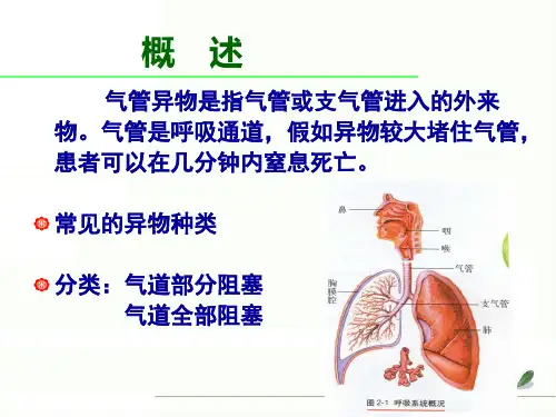 气道异物梗塞救护操作流程