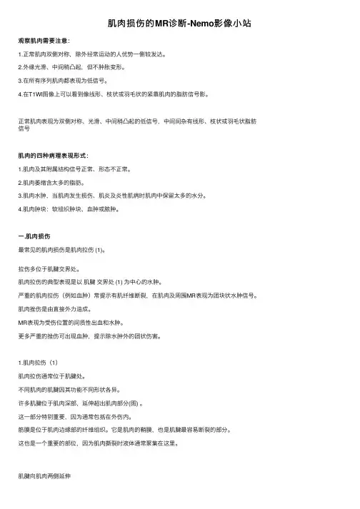 肌肉损伤的MR诊断-Nemo影像小站