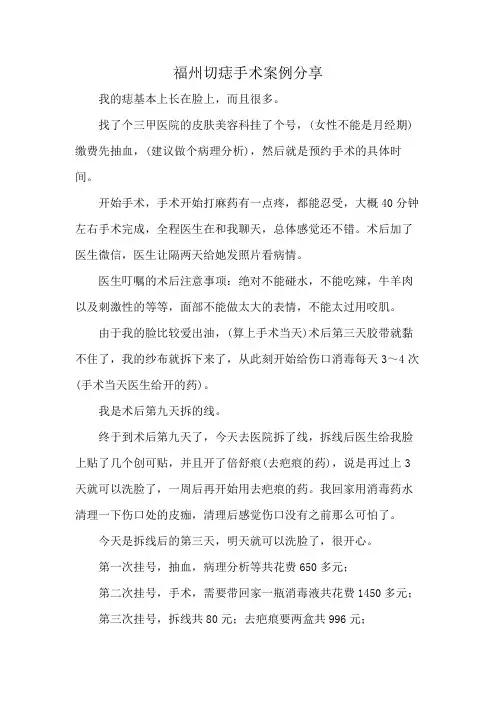 福州切痣手术案例分享