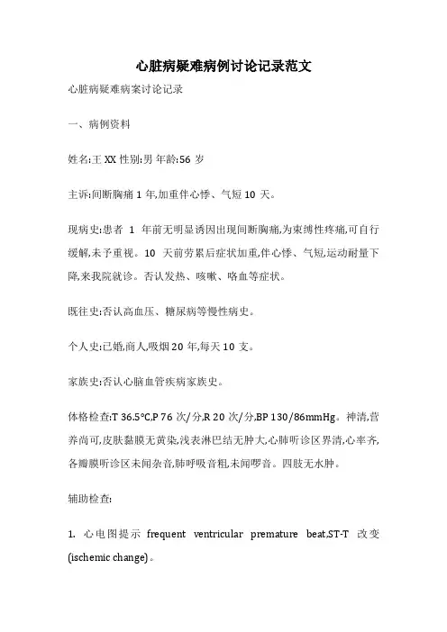 心脏病疑难病例讨论记录范文