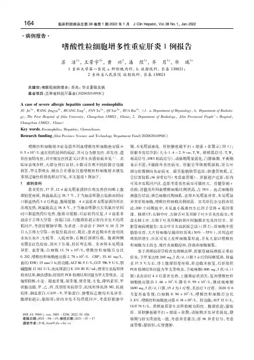 嗜酸性粒细胞增多性重症肝炎1例报告