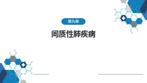 间质性肺疾病呼吸系统疾病内科PPT课件