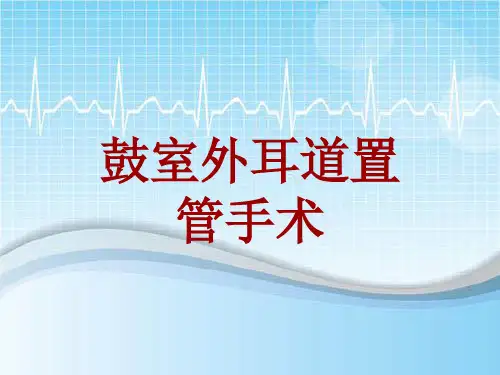 手术讲解模板：鼓室外耳道置管手术