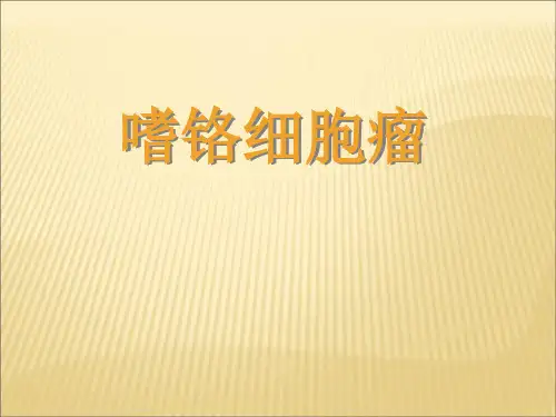 嗜铬细胞瘤