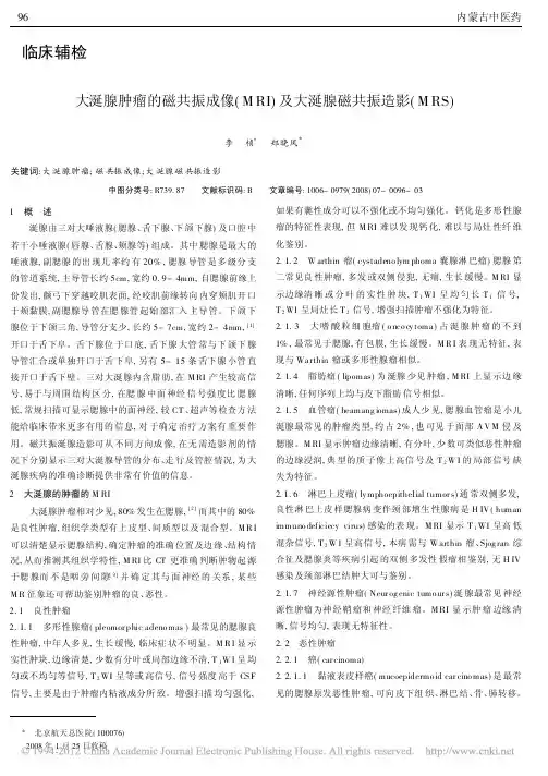 大涎腺肿瘤的磁共振成像_MRI_及大涎腺磁共振造影_MRS_