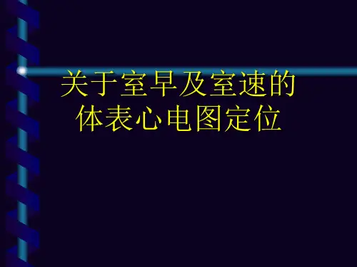 关于室早及室速的体表心电图定位课件