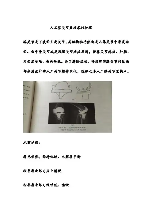 人工膝关节置换术的护理