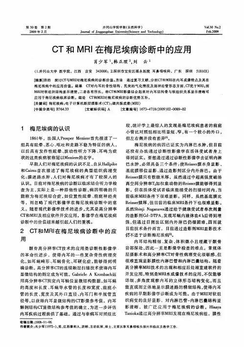 CT和MRI在梅尼埃病诊断中的应用