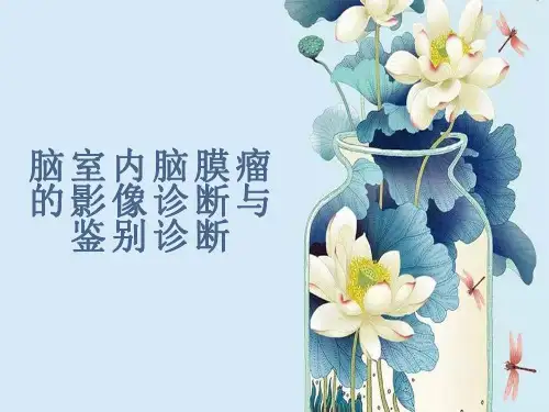 脑室内脑膜瘤的影像诊断与鉴别诊断