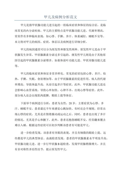 甲亢及病例分析范文