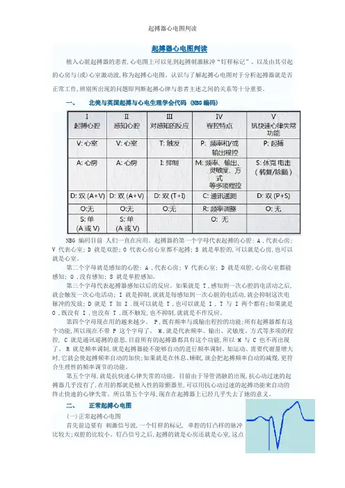 起搏器心电图判读