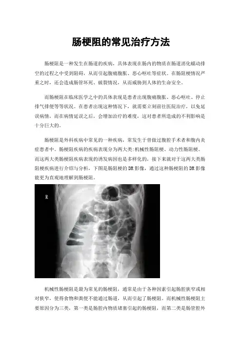 肠梗阻的常见治疗方法