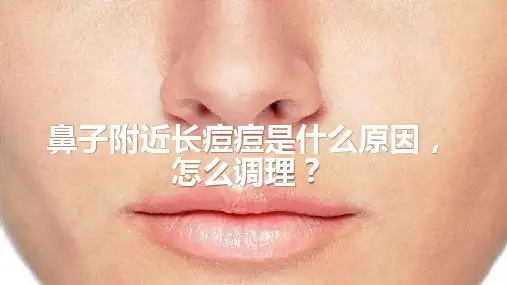 鼻子附近长痘痘是什么原因,怎么调理