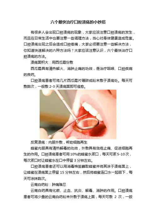 六个最快治疗口腔溃疡的小妙招