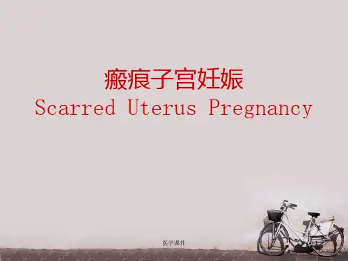 瘢痕子宫妊娠  ppt课件