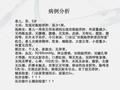 小儿肾病综合征.
