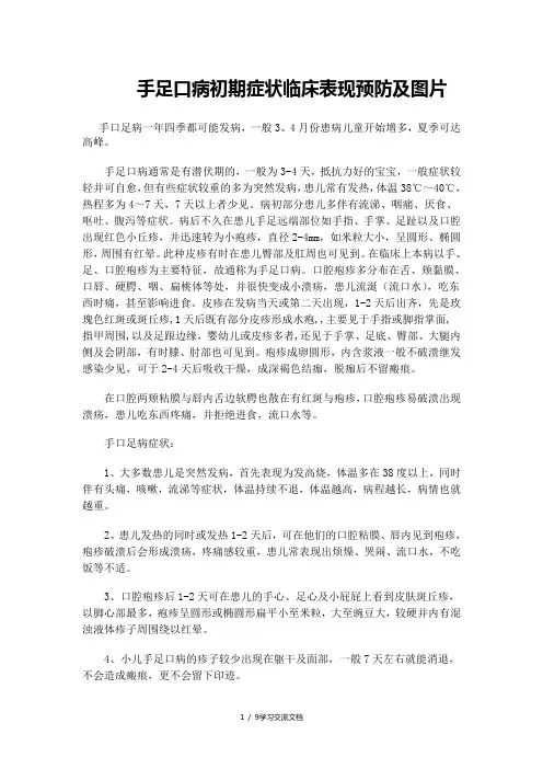 手足口病初期症状及图片