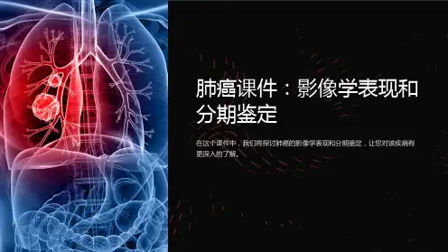 肺癌课件：影像学表现和分期鉴定