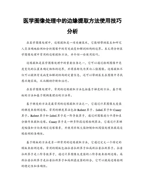 医学图像处理中的边缘提取方法使用技巧分析