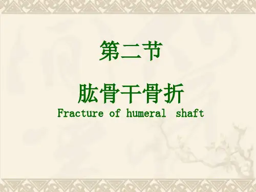 肱骨干骨折ppt课件