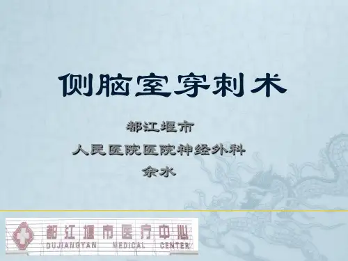 侧脑室穿刺术