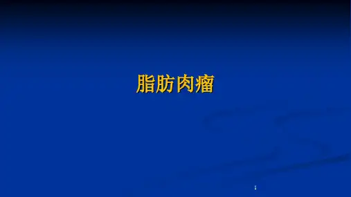 脂肪肉瘤影像诊断PPT课件