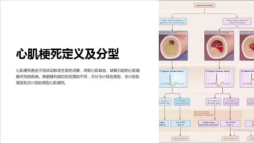 心肌梗死定义及分型
