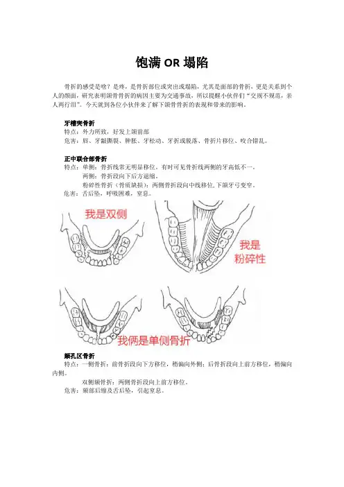 口腔颌面外科-颌骨骨折
