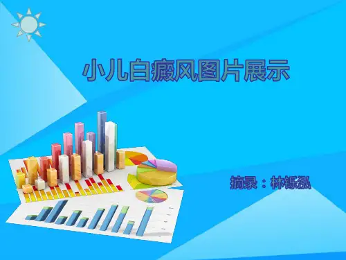 小儿白癜风症状图片展示优质PPT