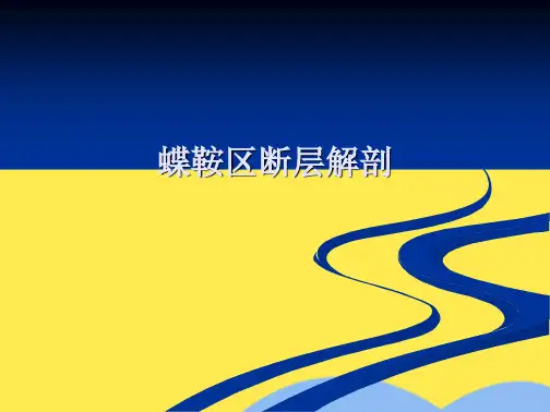 蝶鞍区断层解剖(“垂体”文档)共10张