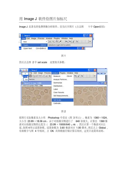 ImageJ软件给图片添加标尺