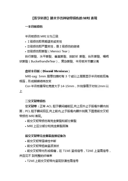 【医学科普】膝关节各种韧带损伤的MRI表现