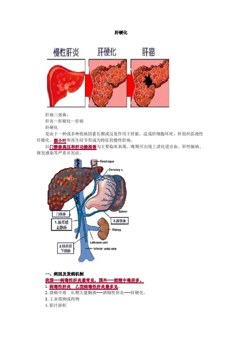 内科护理学-肝硬化