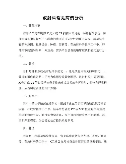 放射科常见病例分析