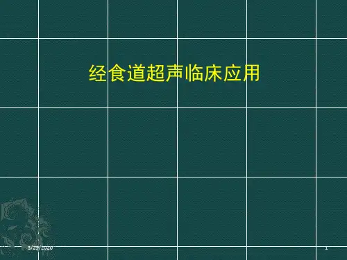 食道超声课件(课堂PPT)