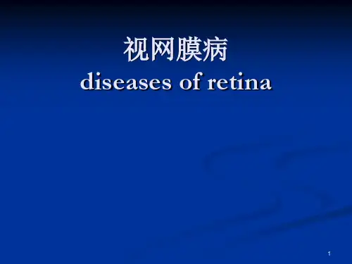 视网膜ppt课件