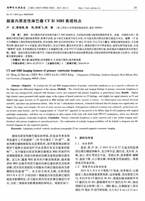 脑室内原发性淋巴瘤CT和MRI表现特点