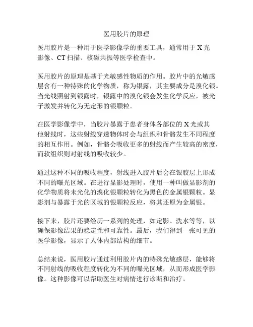 医用胶片的原理