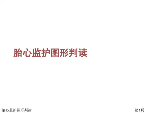 胎心监护图形判读