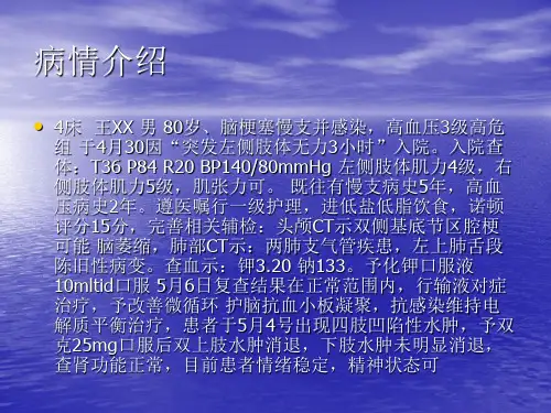 脑梗塞治疗指南