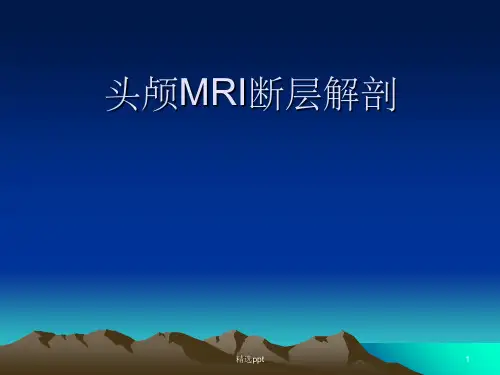 头颅MRI断层解剖PPT课件