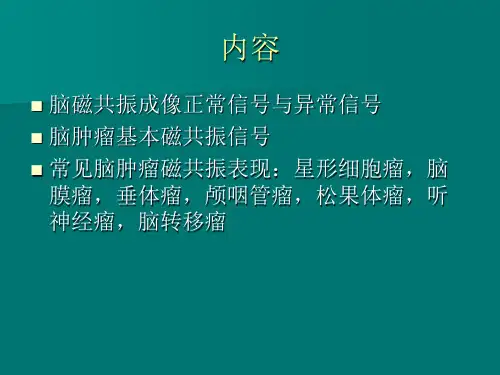 脑肿瘤的磁共振诊断