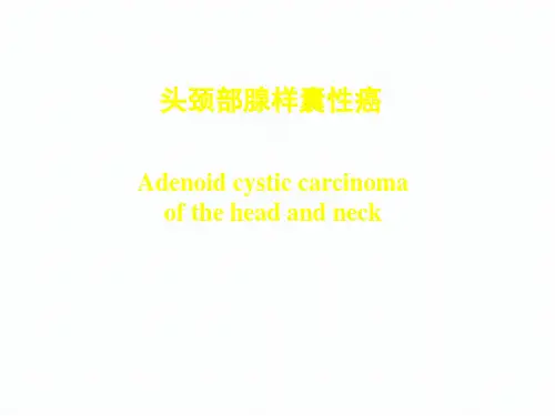 头颈部腺样囊性癌研究进展-2017分析