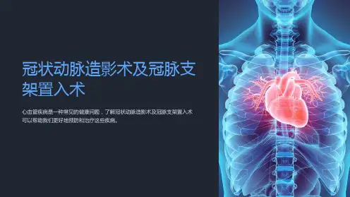 冠状动脉造影术及冠脉支架置入术