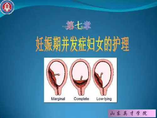 护理系《妇产科护理学》教学课件